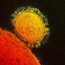 В Греции зафиксировали случай заболевания коронавирусом MERS