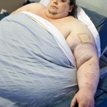 Самый толстый человек в мире, весящий 450 кг, умер в Лондоне