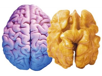 Ученые выяснили, что скопление жира в мозге может привести к болезни Альцгеймера