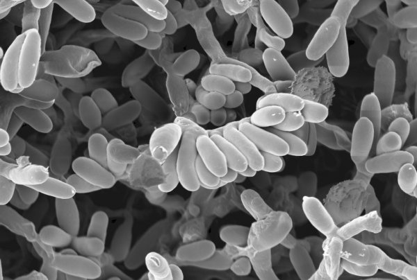 Антибиотик под микроскопом при инфекциях мочеполовой системы