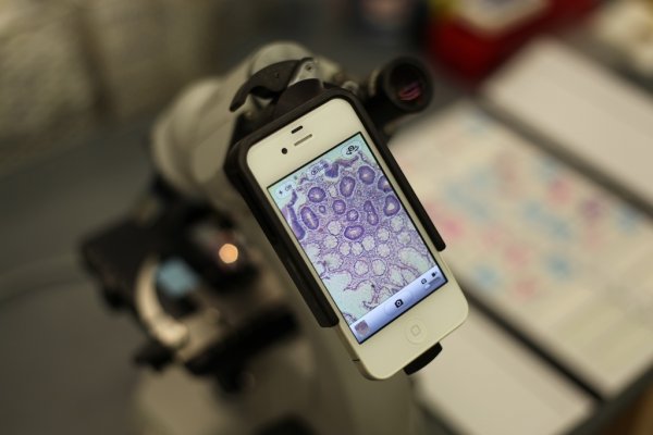 Ученые: Микроскопы на смартфонах можно использовать для выявления рака кожи