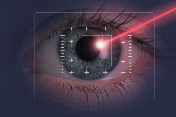 Ученые из МГУ создали лазер для лечения глаз