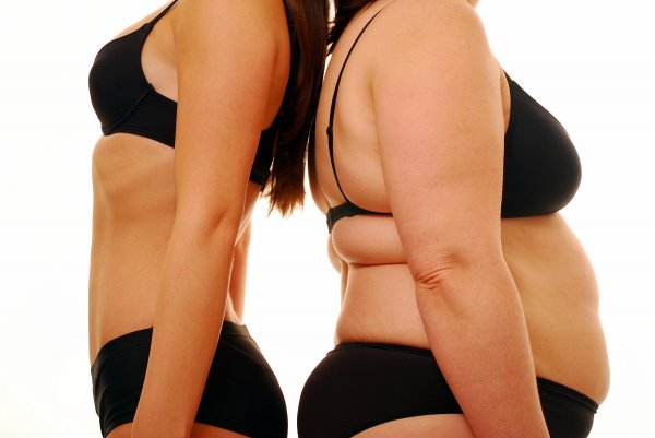 Ученые: Лишний вес больше не вреден для здоровья
