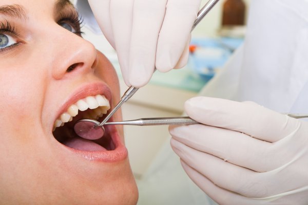 Зубные пломбы могут увеличивать содержание ртути в организме