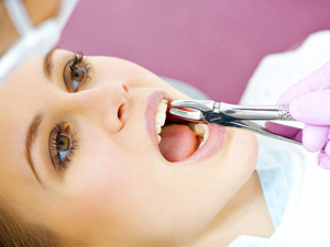 Что делать после удаления зуба и как подготовиться к его удалению?