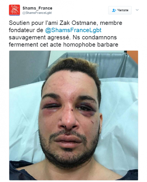 В Марселе избили и изнасиловали ЛГБТ-активиста из Алжира