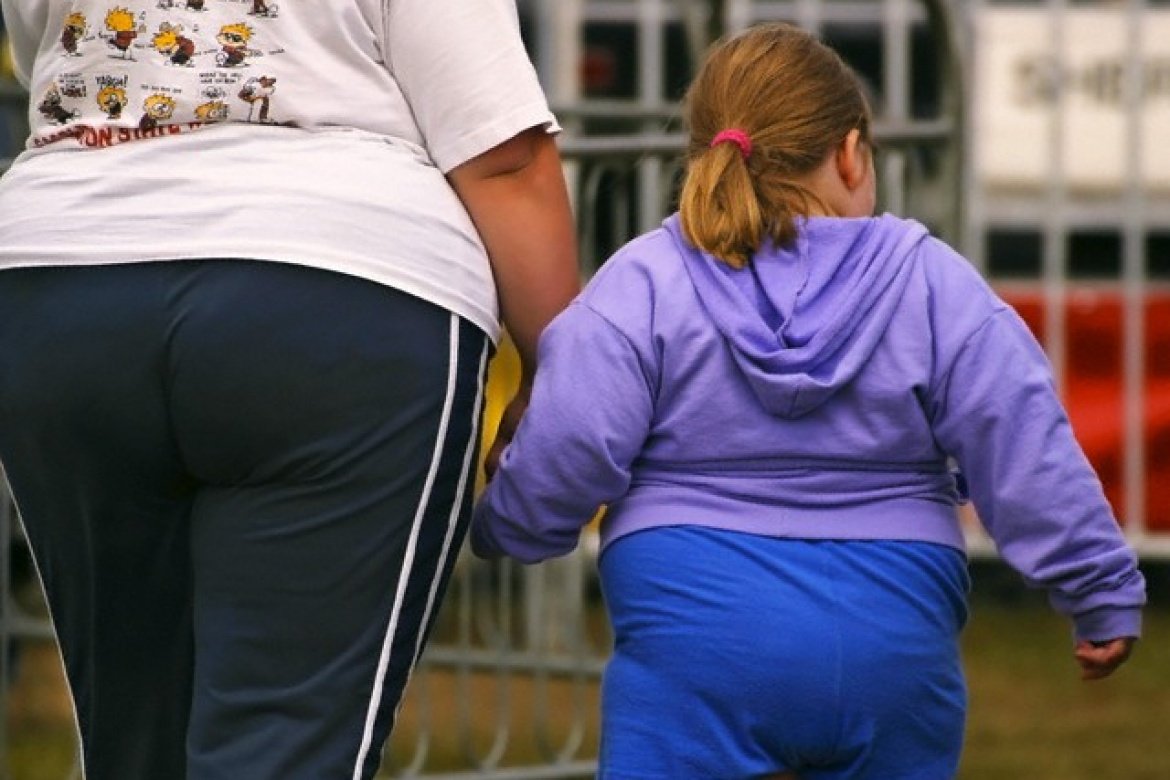 Ожирение опаснее, чем сигареты, диабет либо гипертония — Исследование