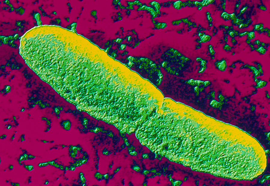 Биологи узнали, почему чума не пропала окончательно