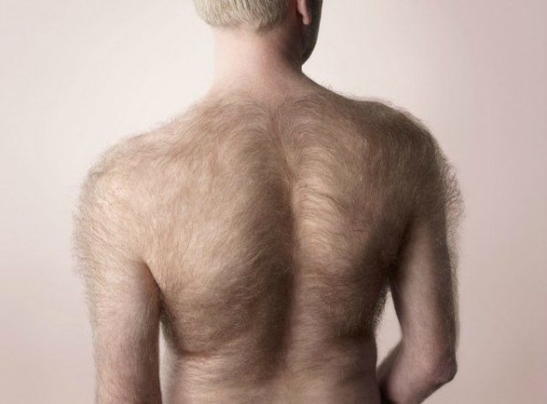 Эксперты рассказали, как избавиться от волос на спине