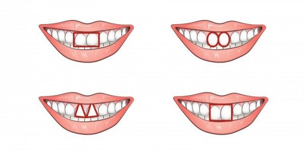 Ученые: Передние зубы расскажут об эгоизме