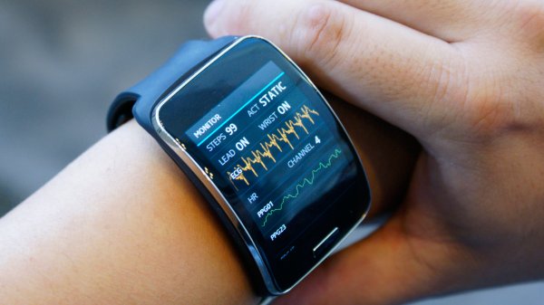 "Умные" часы Apple Watch научат предугадывать болезни сердца