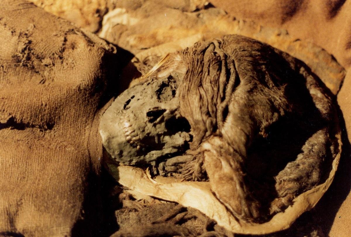 В останках древнеегипетской мумии нашли злокачественную опухоль