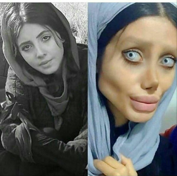 Иранская фанатка Анджелины Джоли пережила 50 пластических операций и стала похожей на зомби