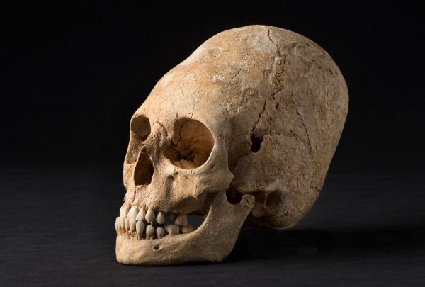 Ученые объяснили природу «черепов пришельцев» у древних инков