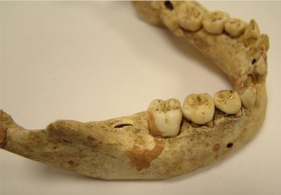 Британские ученые исследовали зубы детей Средневековья
