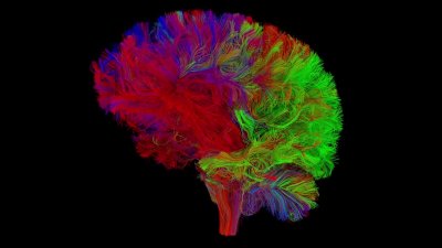 Ученые: Мозг самостоятельно отсеивает и забывает ненужную информацию