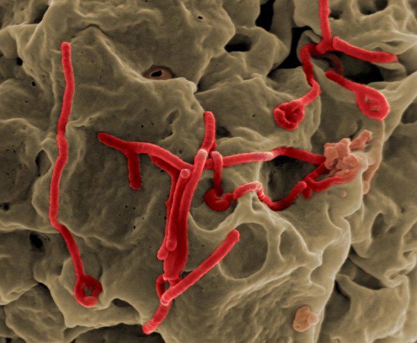 По анализу крови можно предсказать, выживет ли зараженный вирусом Эбола