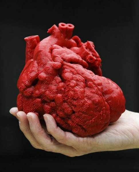 Пациенты с избыточным весом реже умирают после операций на сердце