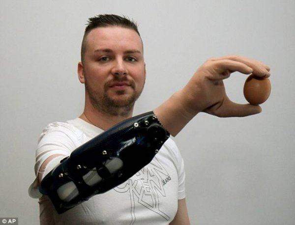 В Америке создали бионический протез руки и назвали его в честь Люка Скайуокера