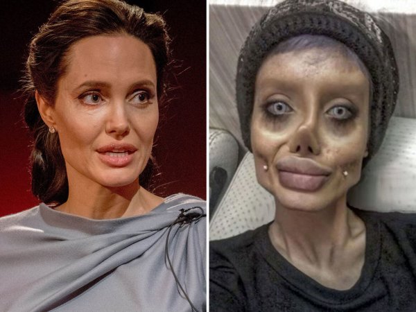 Иранская фанатка Анджелины Джоли пережила 50 пластических операций и стала похожей на зомби
