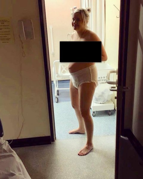 В подгузнике после родов : Голая блогерша показала фото