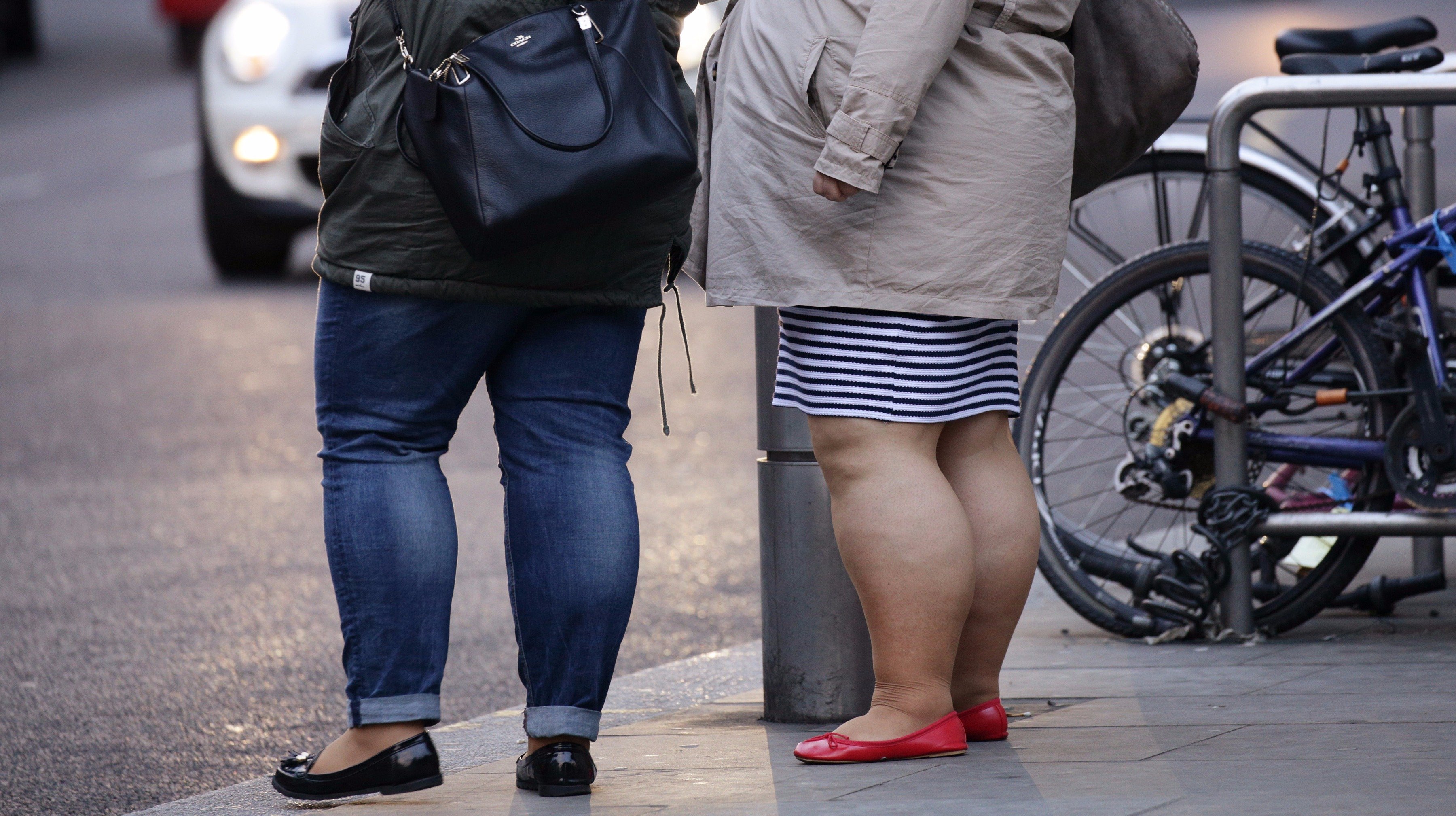Ноги у толстых людей. Жирные люди на улице. Люди с лишним весом на улице.