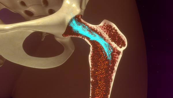 Ученые: Искусственная модель кости с красным костным мозгом поможет победить болезни крови