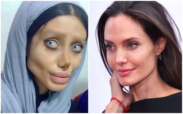 Жуткая «иранская Джоли» попала в больницу со сломанной шеей – СМИ