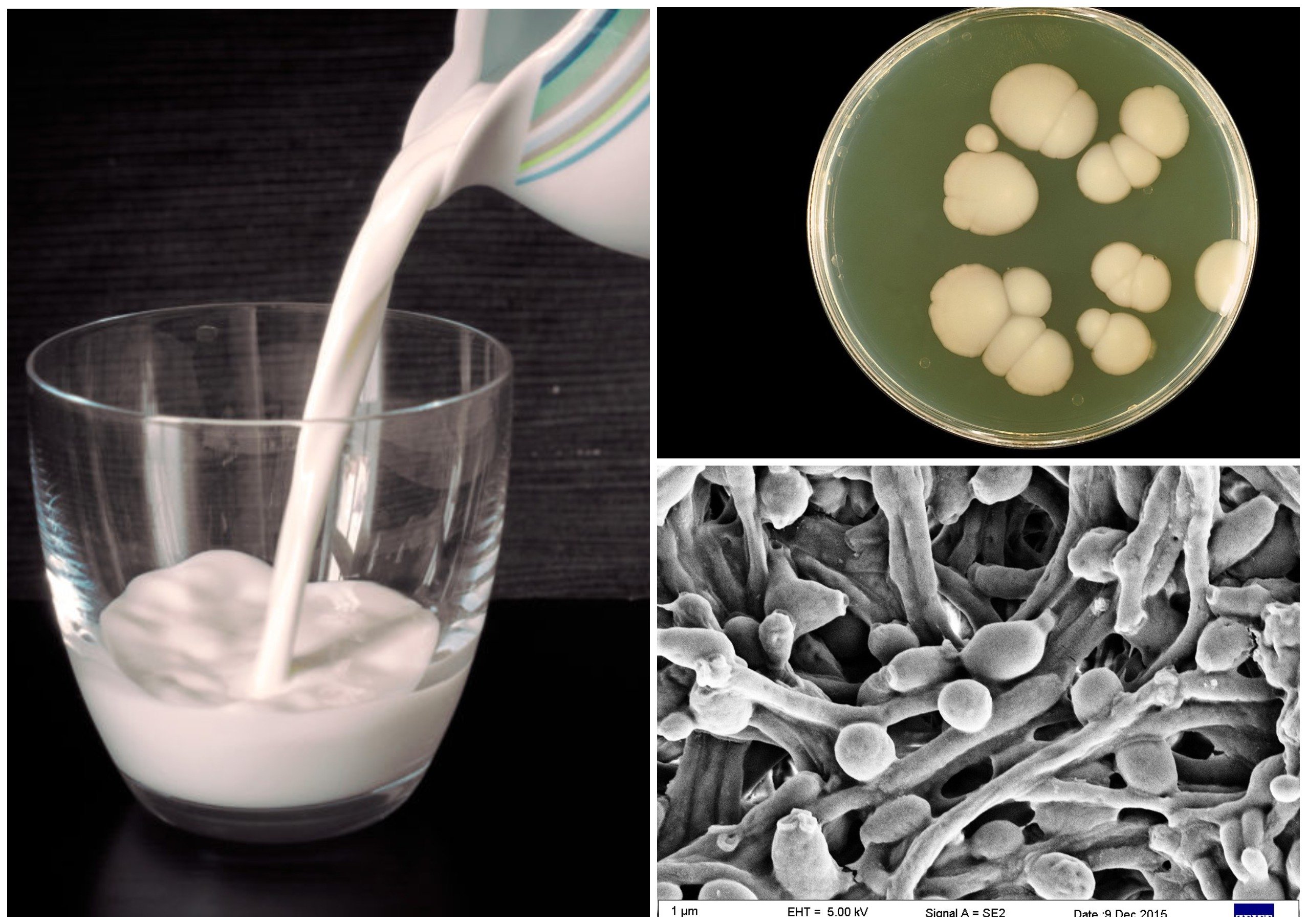Дрожжи используются человеком для производства кисломолочных. Молочные бактерии. Бактерии в молоке. Молочнокислые дрожжи. Молочнокислые бактерии и дрожжи.