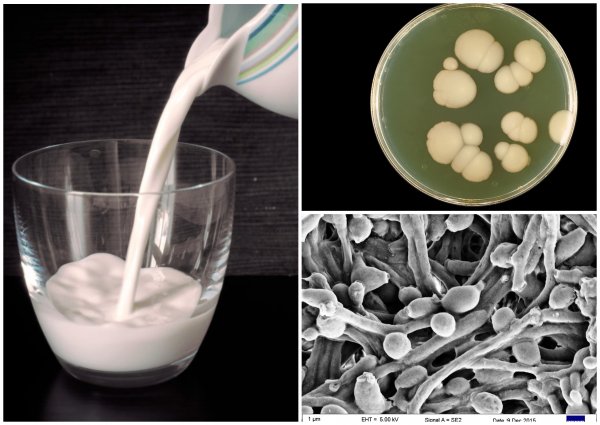 Эксперты рассказали, чем опасны дрожжи в молочных продуктах