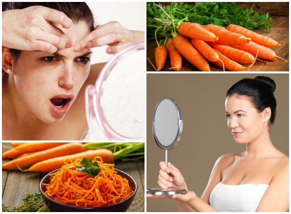 Врачи: Одна морковь в день избавит от прыщей и улучшит состояние кожи у женщин