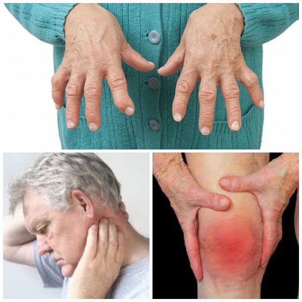 Боль в костях: Симптомы ревматоидного артрита можно почувствовать задолго до определения диагноза