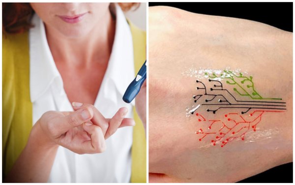 «Заменит глюкометр»: Врачи изобрели татуировки для диабетиков