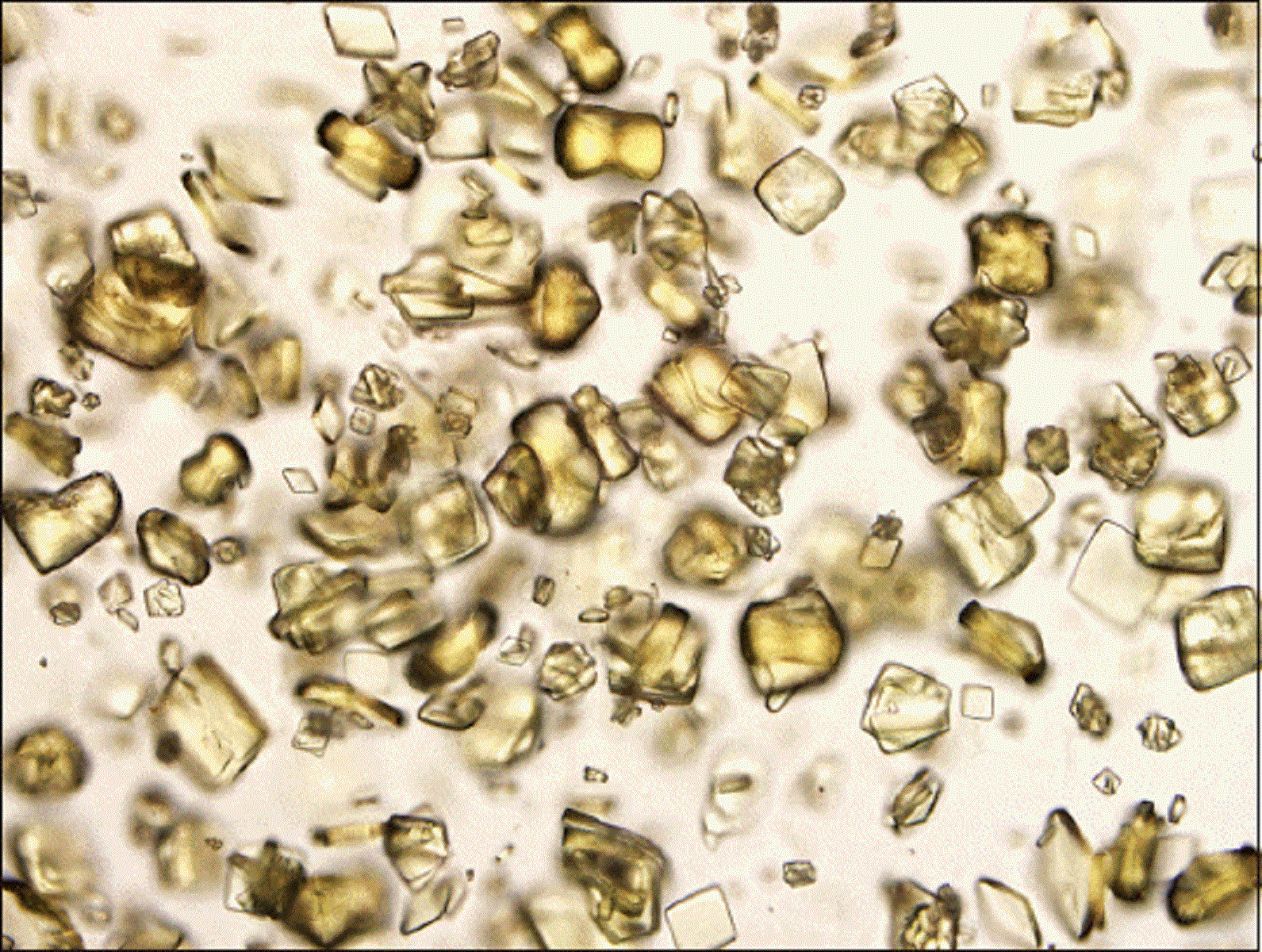 Золотая кровь у человека. Золото в микроскопе. Золотая кровь под микроскопом. Золотой микроскоп.