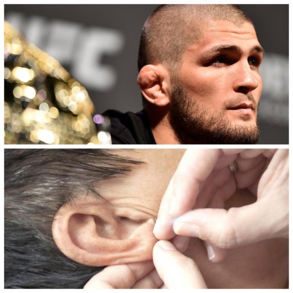 Хабиб стайл: В Махачкале поклонникам UFC ломают уши за деньги